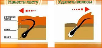 Как провести шугаринг