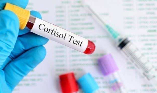 Кортизол: друг и враг 